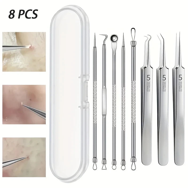 Stainless Steel Blackhead Remover Kit